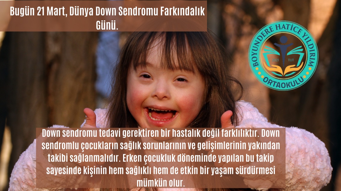 Bugün 21 Mart Dünya Down Sendromu Farkındalık Günü.